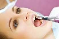 Extracción